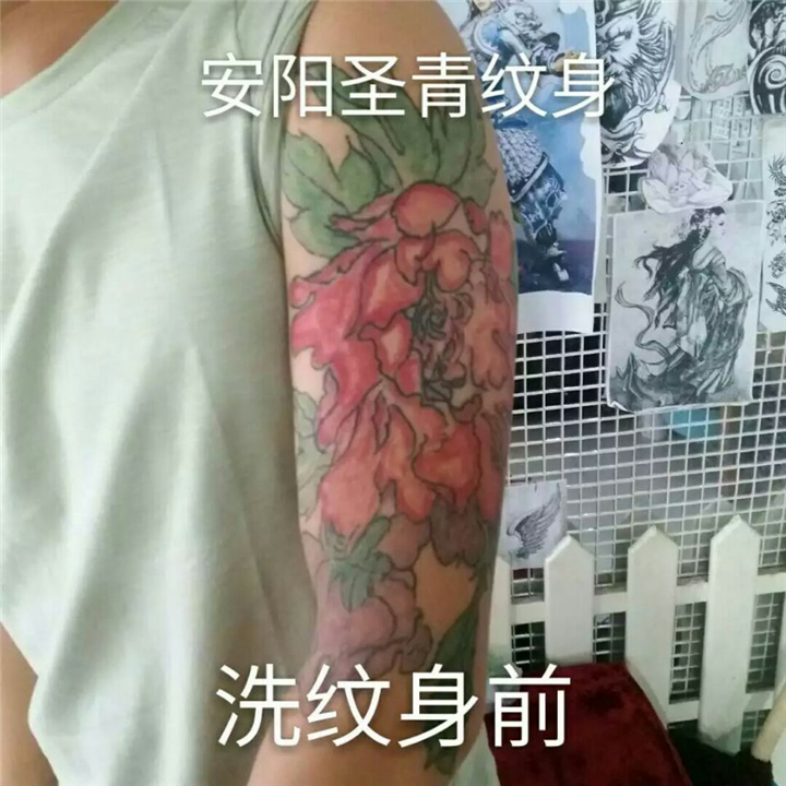安阳洗纹身|安阳洗纹身价格