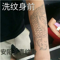 安阳洗纹身|安阳洗纹身怎么样