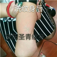 安阳洗纹身|安阳哪家洗纹身好