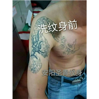 安阳**的洗纹身店