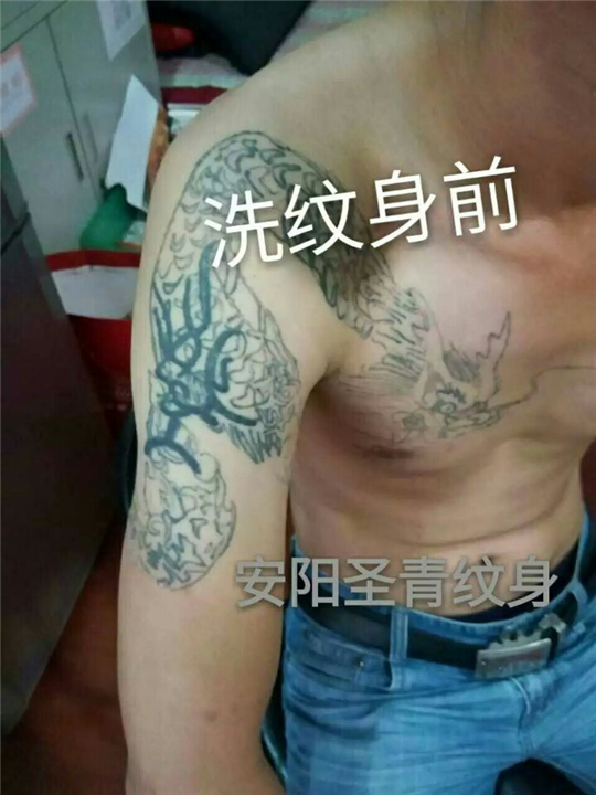 安阳**的洗纹身店