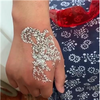 安阳洗纹身/激光祛纹身-圣青