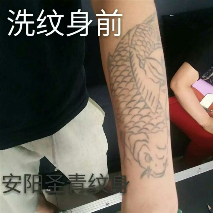 安阳洗纹身|安阳洗纹身怎么样