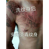 安阳洗纹身|安阳专业洗纹身