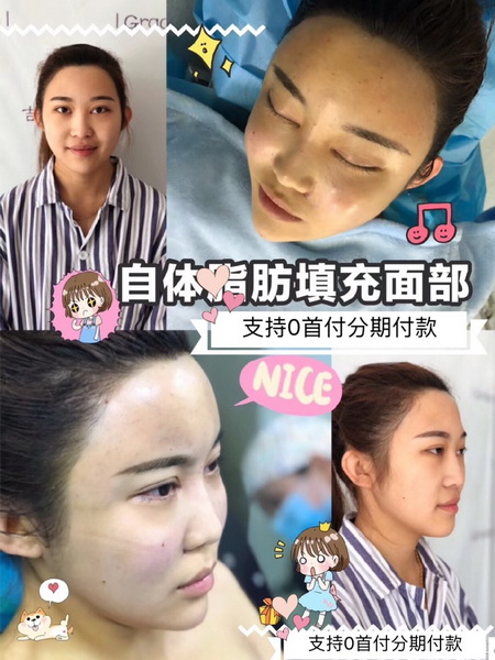 安徽网红整形|安徽人气网红整形