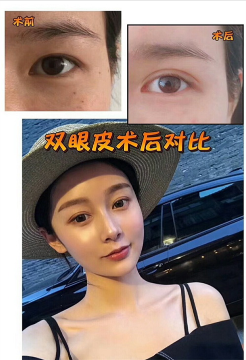 安徽鼻综合整形|安徽眼综合整形
