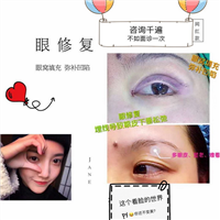 安徽眼综合整形|安徽脂肪填充