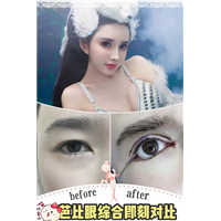 安徽网红全脸打造|安徽自体肋骨隆鼻整形