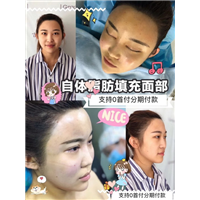 安徽网红整形|安徽人气网红整形