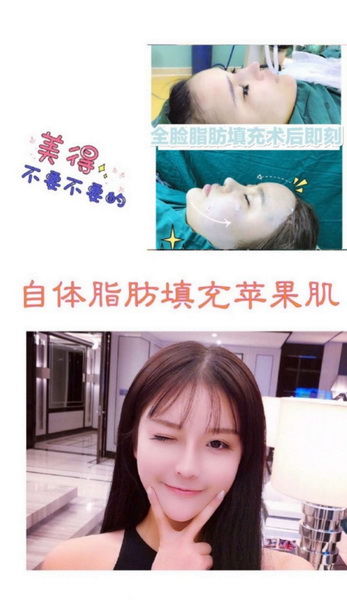 安徽网红整形|安徽人气网红整形