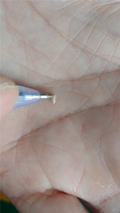 大连灭白蚁公司%大连灭鼠电话￥大连灭白蚁 