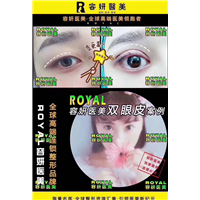 上海网红眼综合整形 