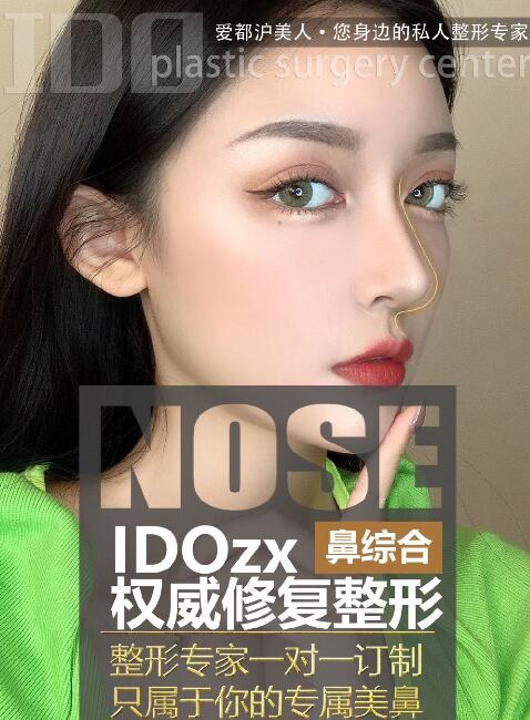 上海ido整形