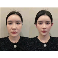 轻医美抗衰加盟
