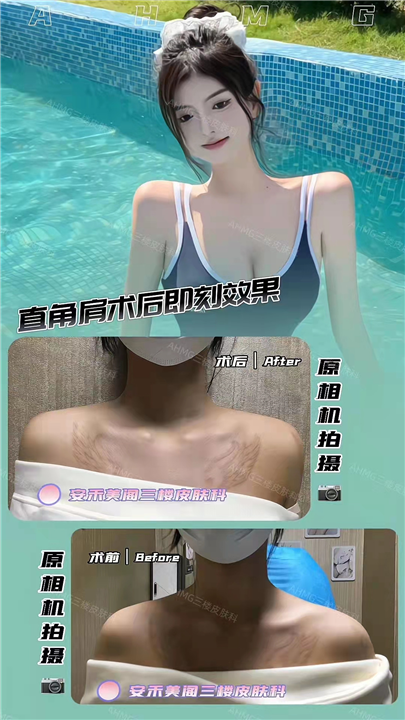 轻医美抗衰加盟