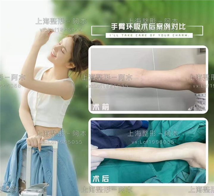 上海美丽之星整形医院
