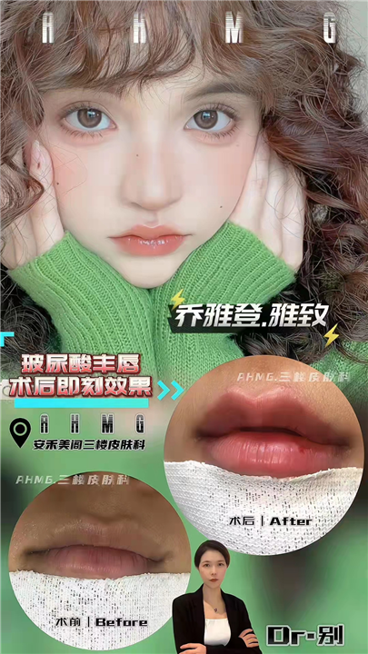 上海轻医美皮肤抗衰
