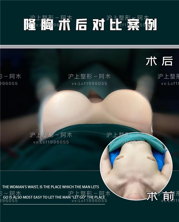 上海整形哪家好
