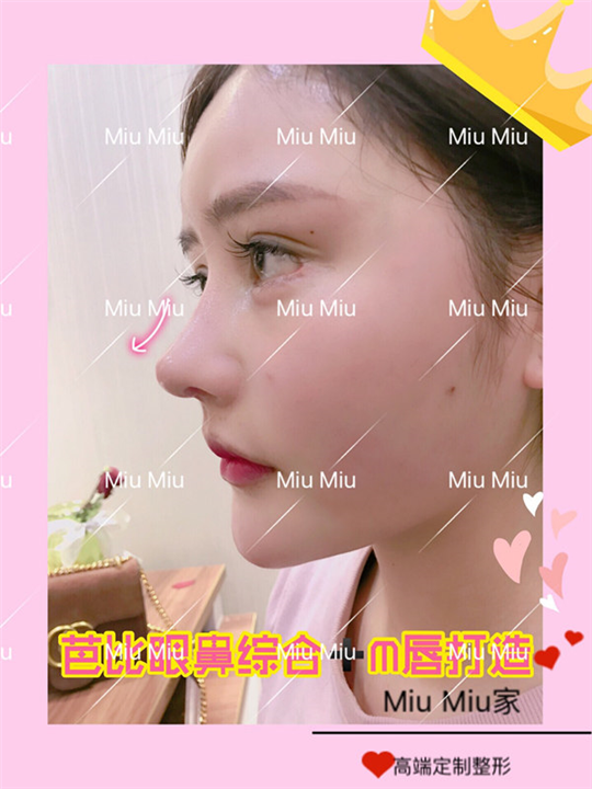 上海眼综合整形医院|上海网红整形哪家好 