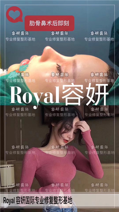 上海鼻整形医院哪家好 