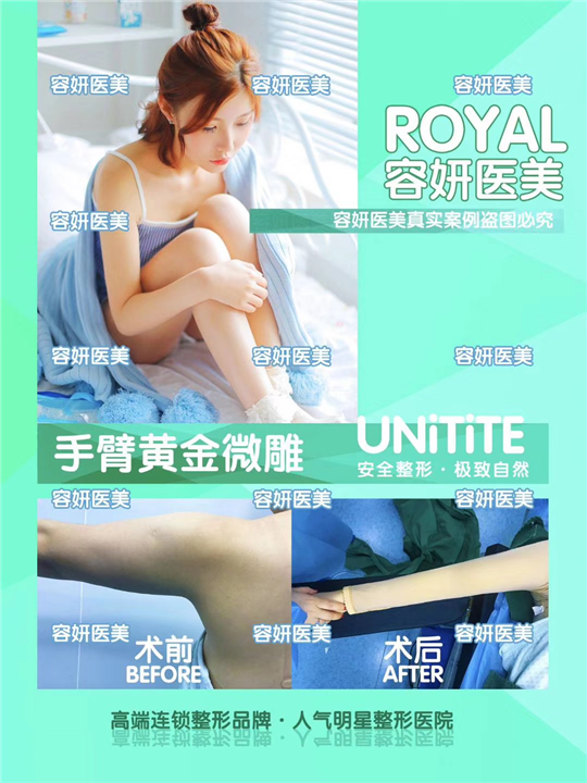 上海手臂吸脂价格 