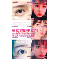上海双眼皮整形价格 