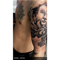 石狮疤痕遮盖多少钱 