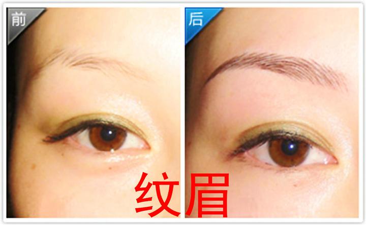 青海哪里可以洗纹眉