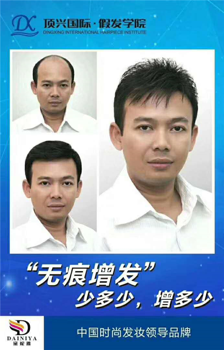 淮南补发 