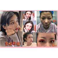 成都美诺晨美容全脸打造
