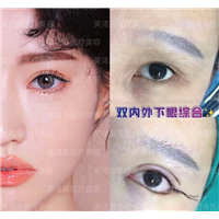 成都美诺晨眼综合整形