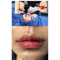 成都唇部整形哪家好