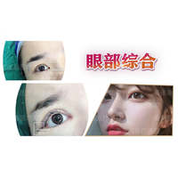 成都美诺晨眼综合整形项目