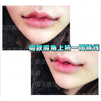 成都美诺晨整形