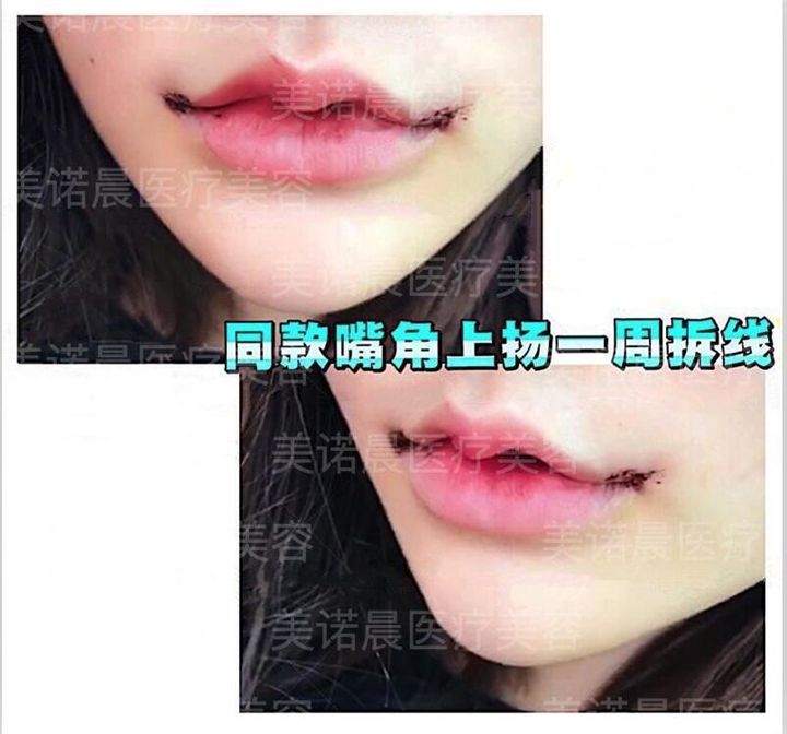 成都美诺晨整形