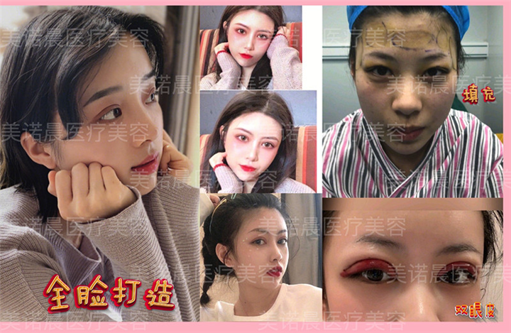 成都美诺晨美容全脸打造