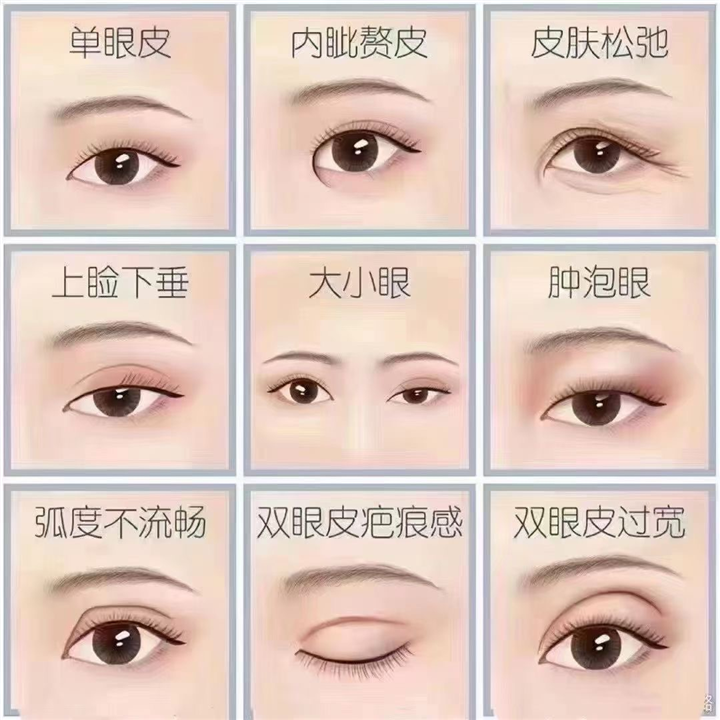 上海眼综合整形医生