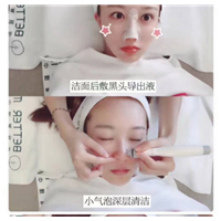 大连皮肤管理哪家好|大连微整