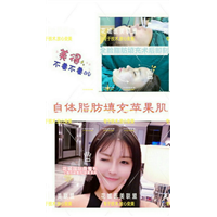 上海网红整形医院|上海专业网红整形 