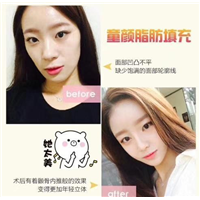 上海专业网红整形|上海整形修复医院 