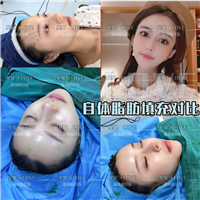 星璨国际整容 
