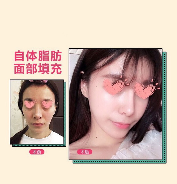 上海整形修复医院|上海星璨整形 