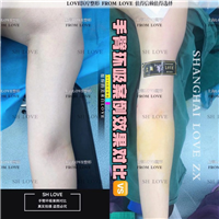 手臂抽脂 