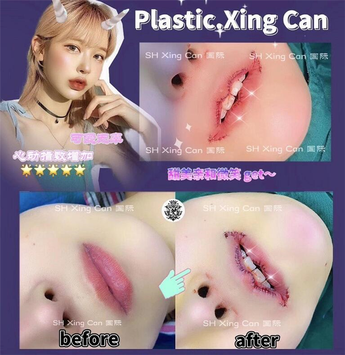 上海星璨是正规医院吗
