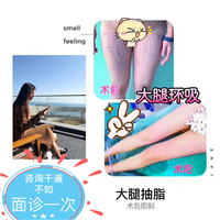大腿环吸术后即刻