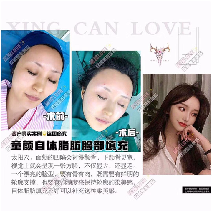 上海星璨哪个医生好 