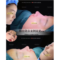 上海星璨口碑