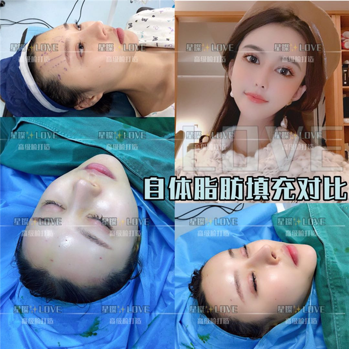 星璨国际整容 