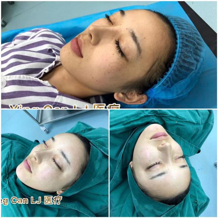上海星璨国际医疗美容 