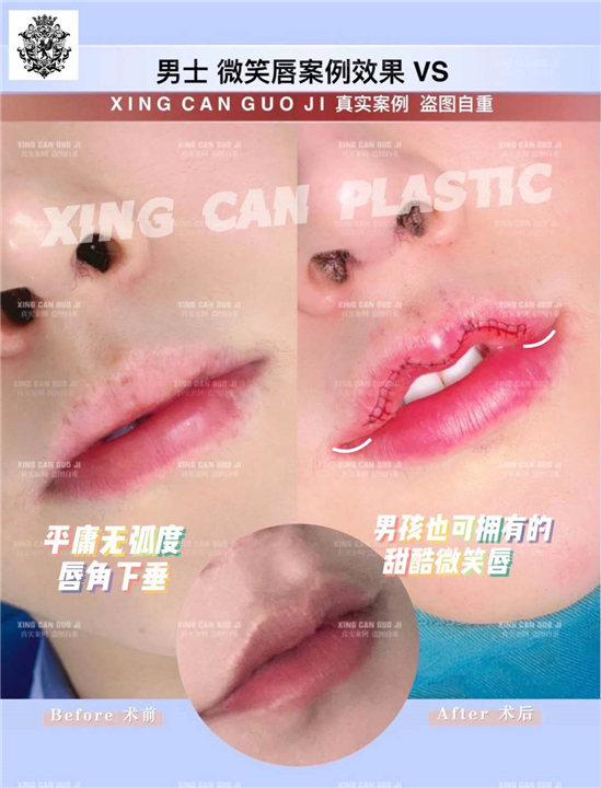 上海星璨是正规医院吗